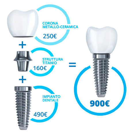 costo impianto dentale firenze