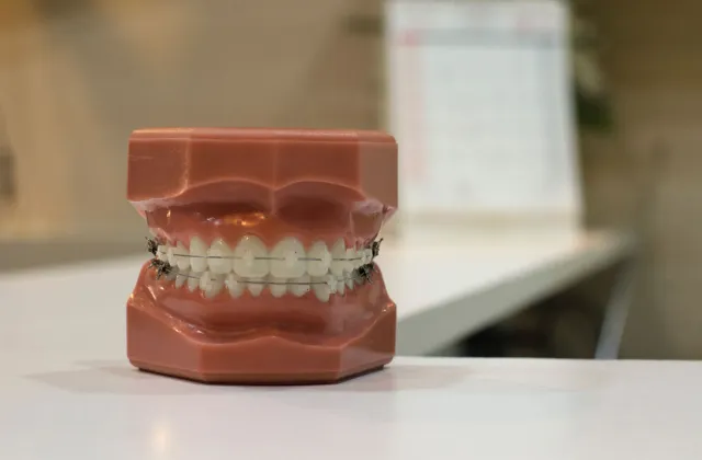 ortodonzia correggere i difetti dei denti