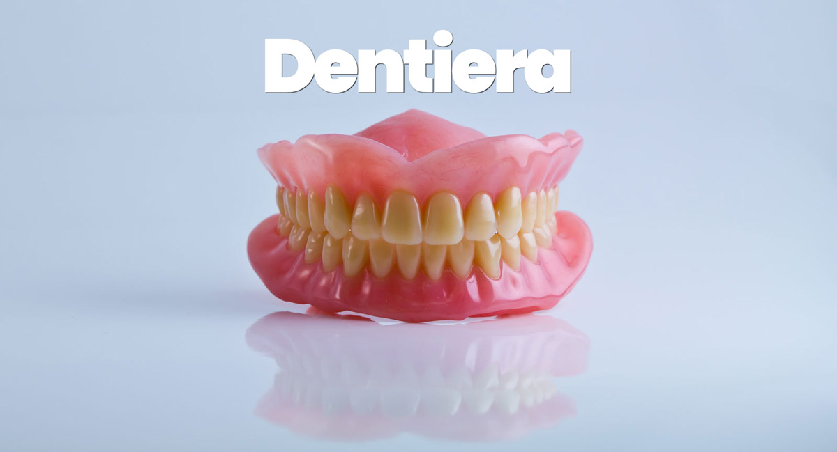 Dentiera - Tutto quello che c'è da sapere