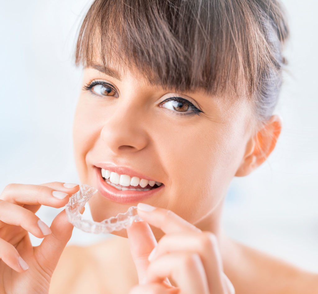 apparecchio invisibile invisalign