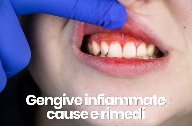 gengive infiammatissime cause e rimedi