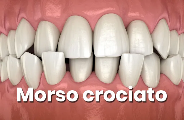 morso crociato