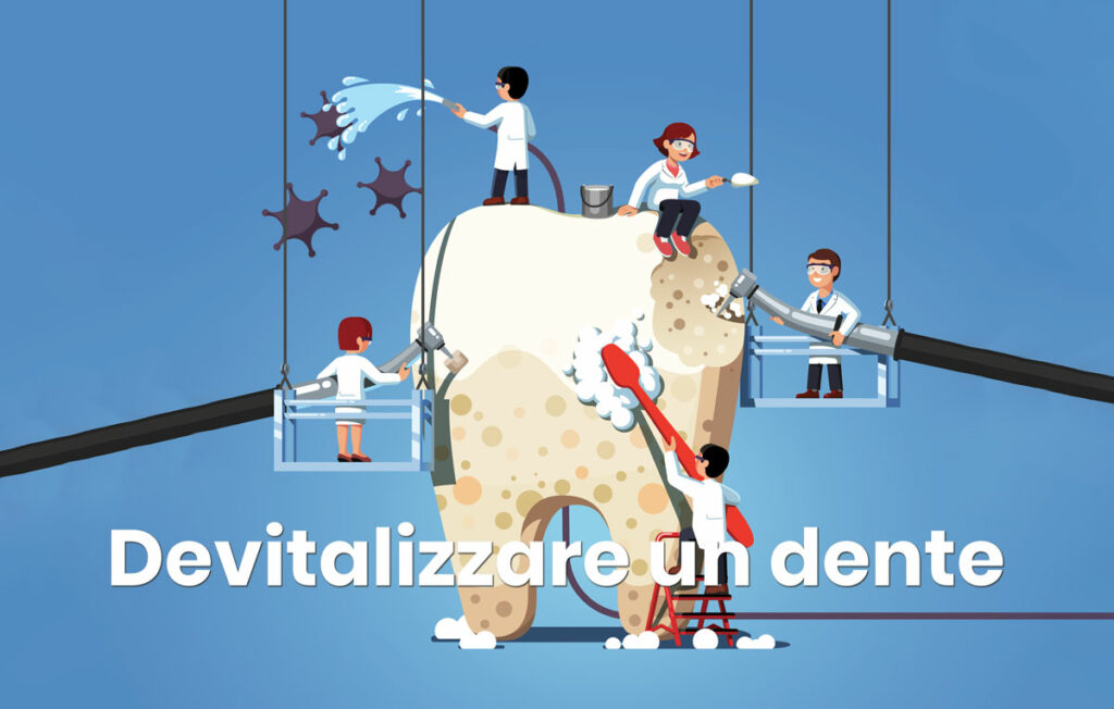 devitalizzare un dente