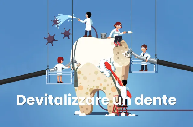 devitalizzare un dente