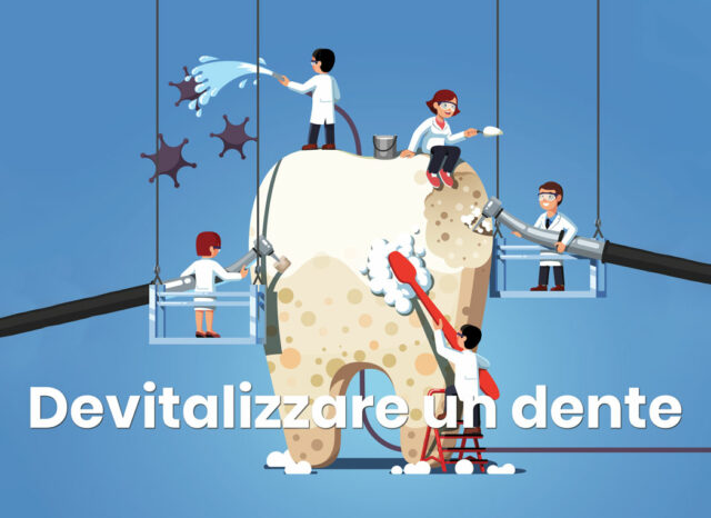 devitalizzare un dente