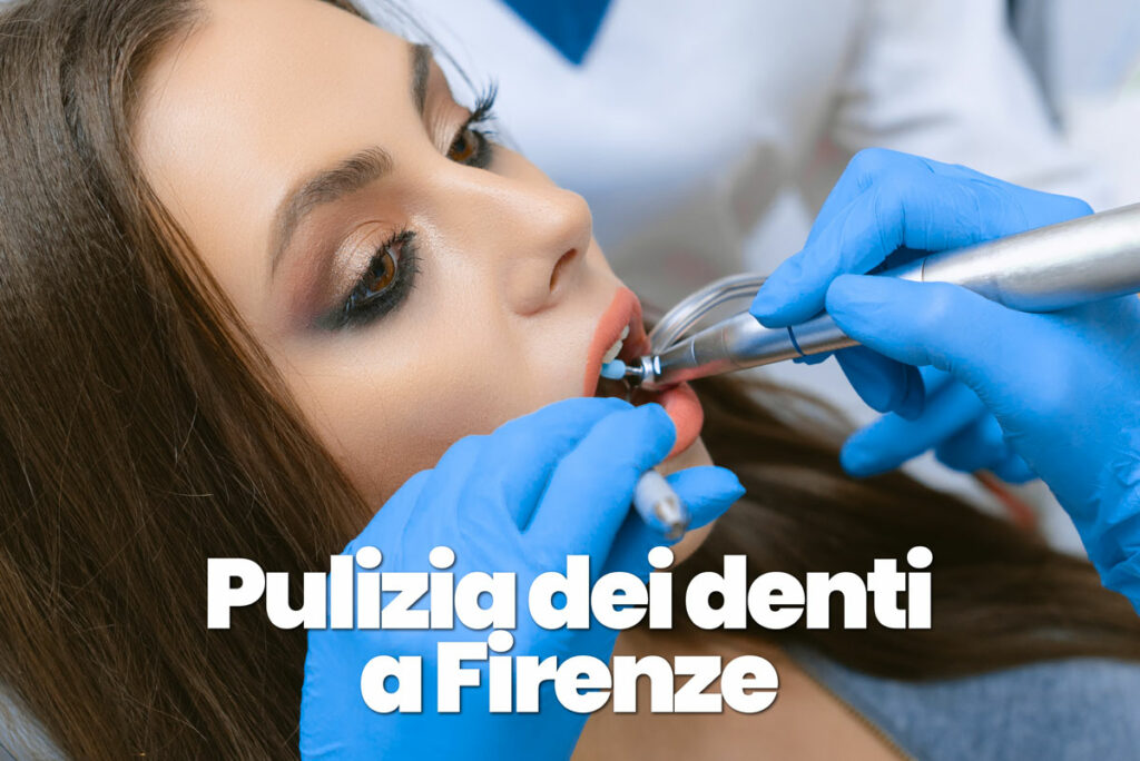 pulizia dei denti professionale a Firenze