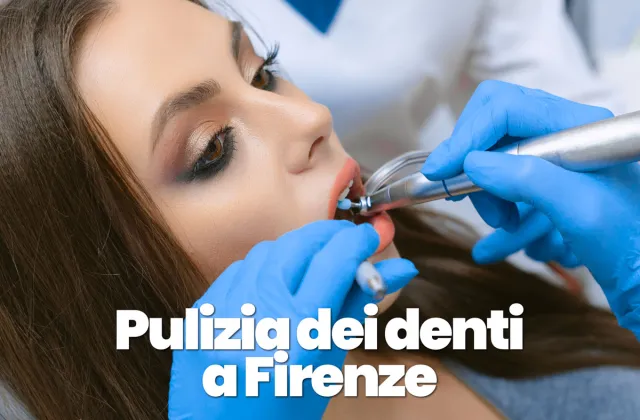 pulizia dei denti professionale a Firenze