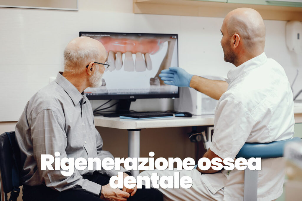 rigenerazione ossea dentale