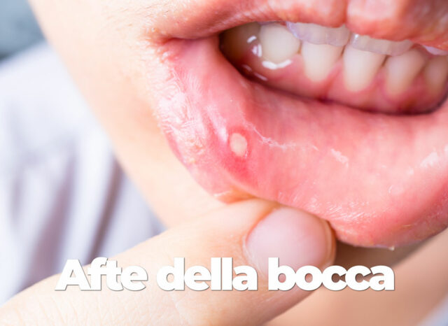 Ciuccio denti: quali danni possibili? - Dentista a Firenze - Dr