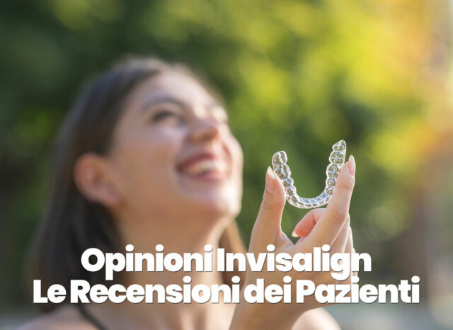 opinioni e recensioni Invisalign