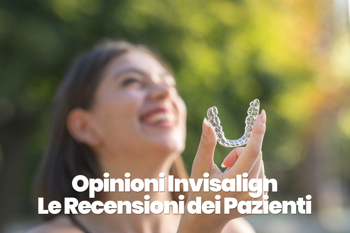 opinioni e recensioni Invisalign