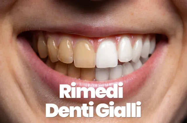 rimedi per i denti gialli