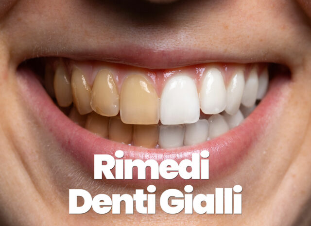 rimedi per i denti gialli