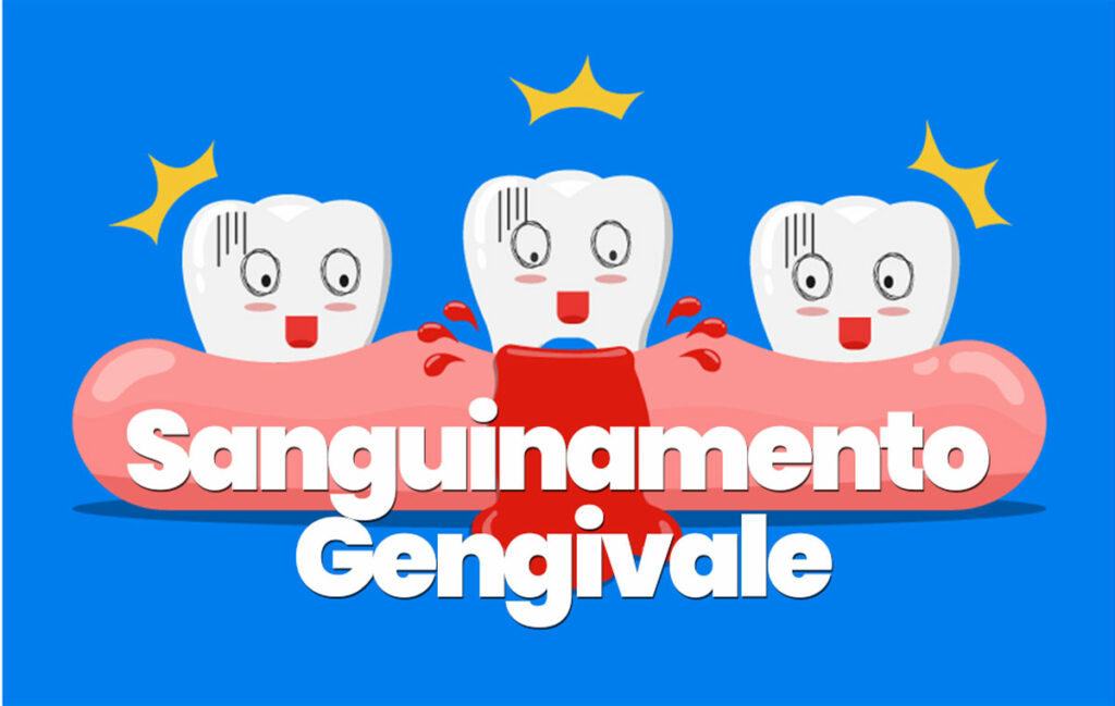 sanguinamento gengivale