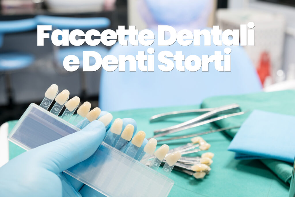 faccette dentali e denti storti