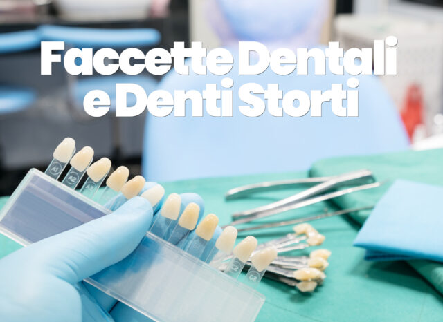 faccette dentali e denti storti