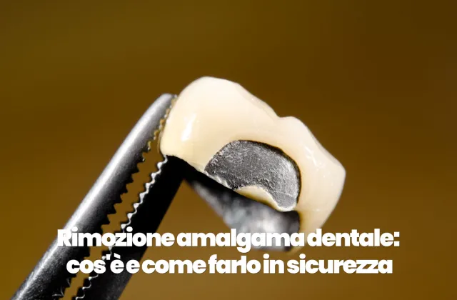 rimozione otturazioni in amalgama