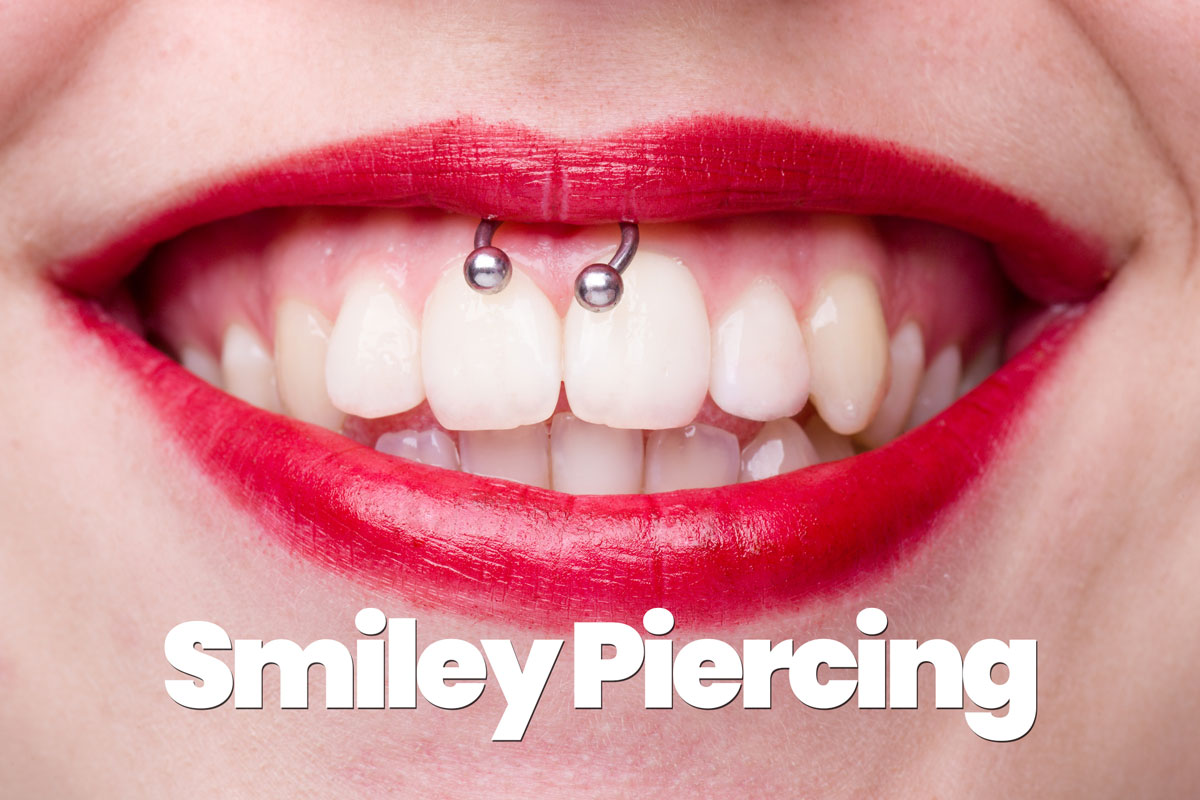 Smiley piercing