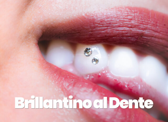 brillantino al dente