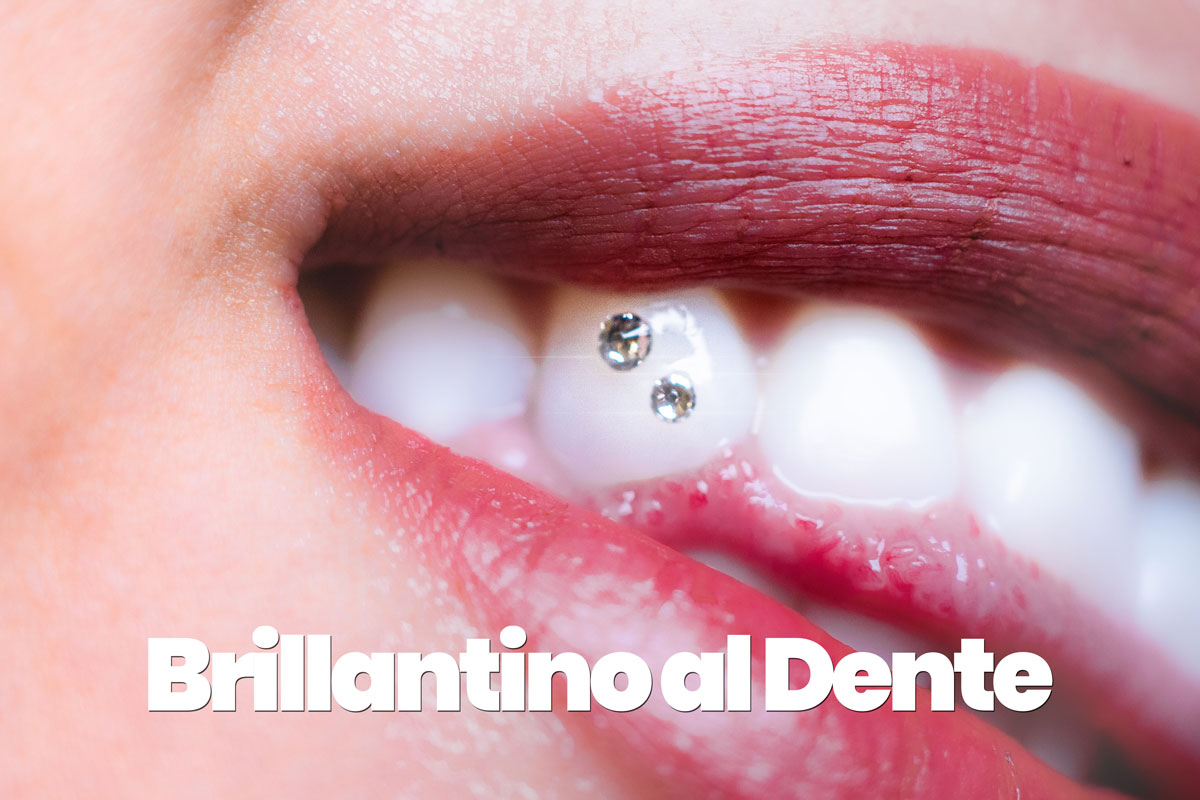 Brillantini ai denti estate 2022: le tooth gems, idee in foto