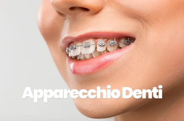 Apparecchio ai denti: quando si deve mettere da adulti