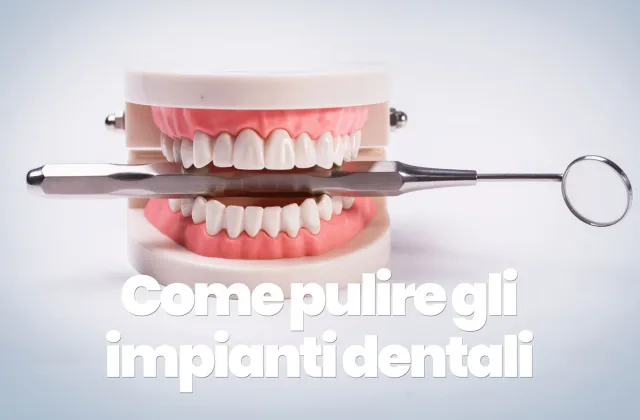 come pulire un impianto dentale