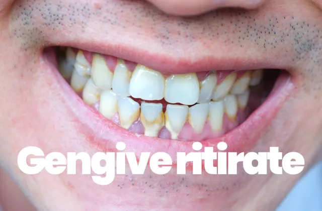 gengive ritirate