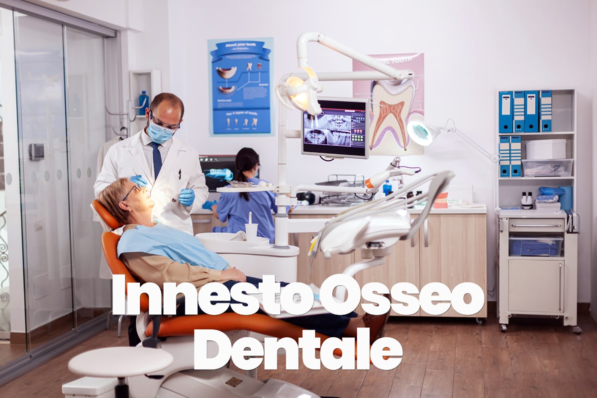 innesto osseo dentale