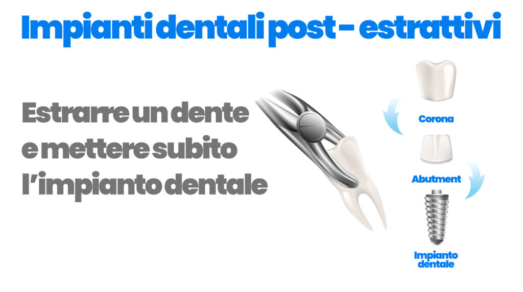 impianti dentali post estrattivi