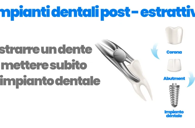 impianti dentali post estrattivi