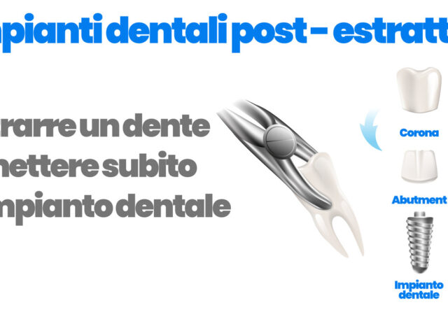 impianti dentali post estrattivi