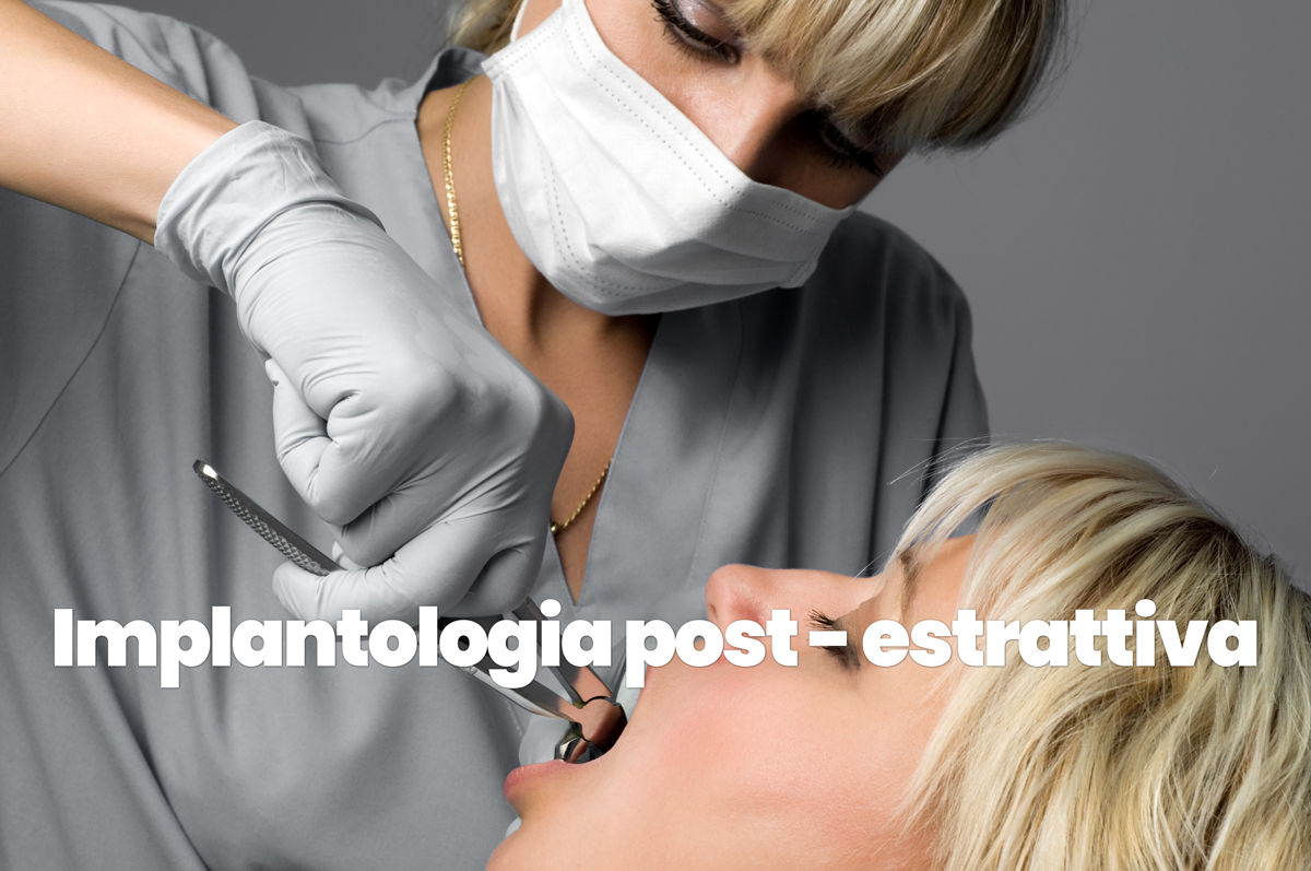 dentista che estrae un dente e mette un impianto post estrattivo