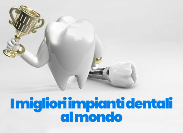 migliori impianti dentali