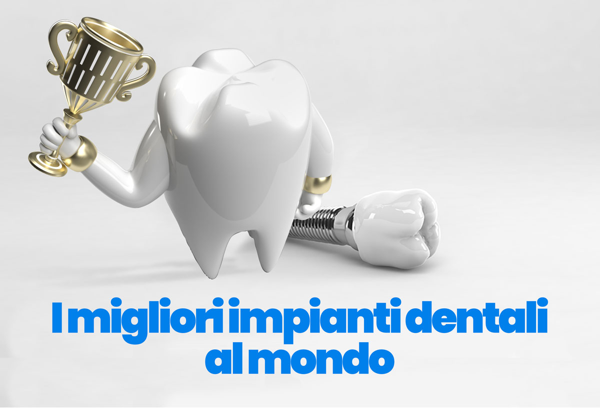 migliori impianti dentali