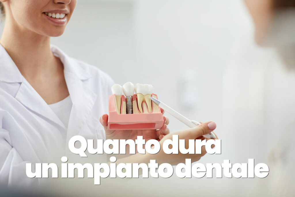 quanto dura un impianto dentale