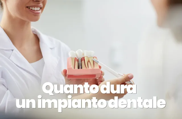quanto dura un impianto dentale
