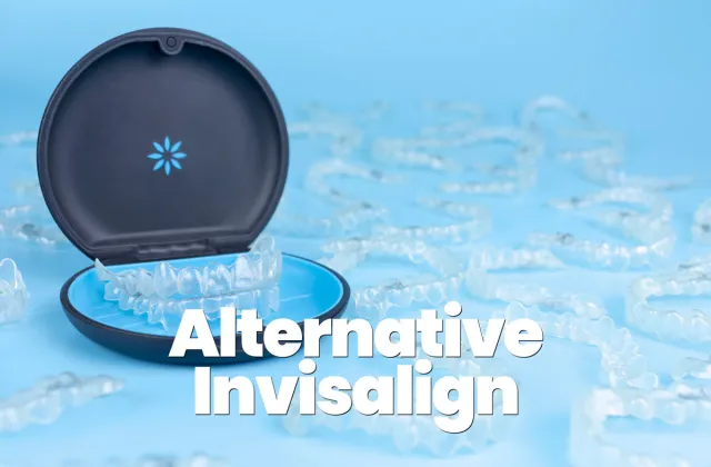 alternative economiche invisalign