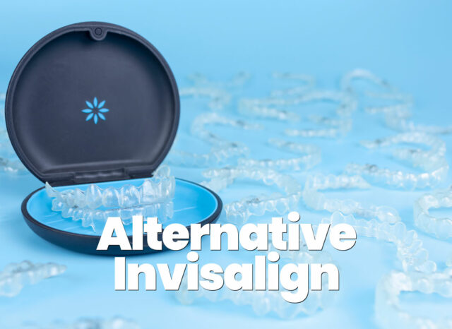 alternative economiche invisalign