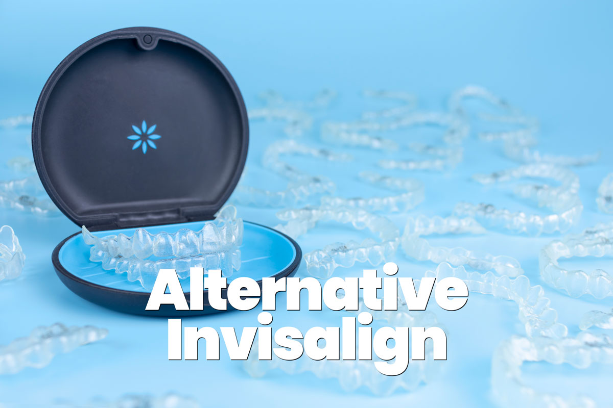 alternative economiche invisalign