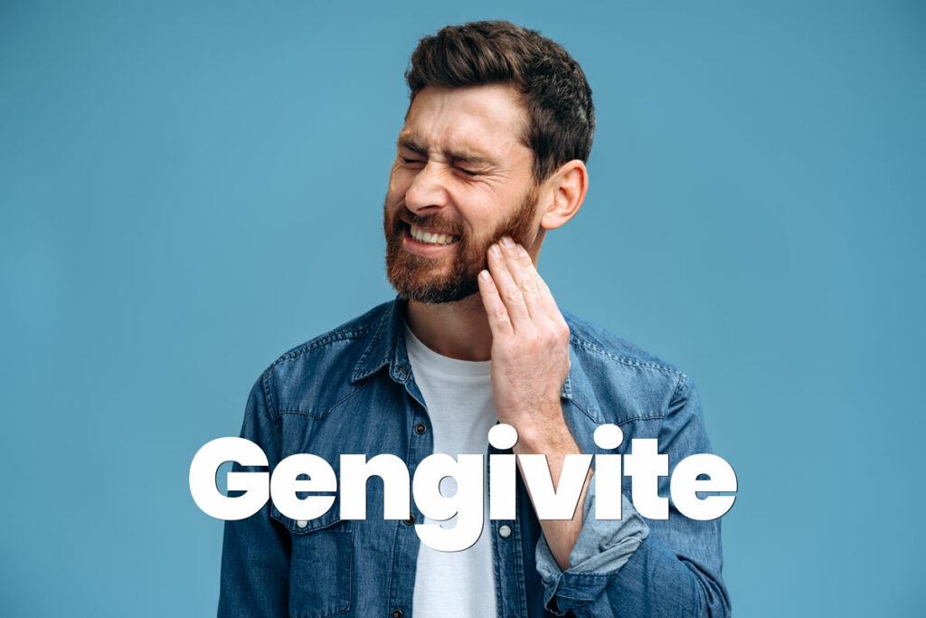 gengivite