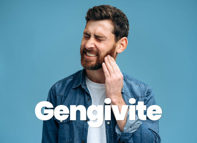 gengivite