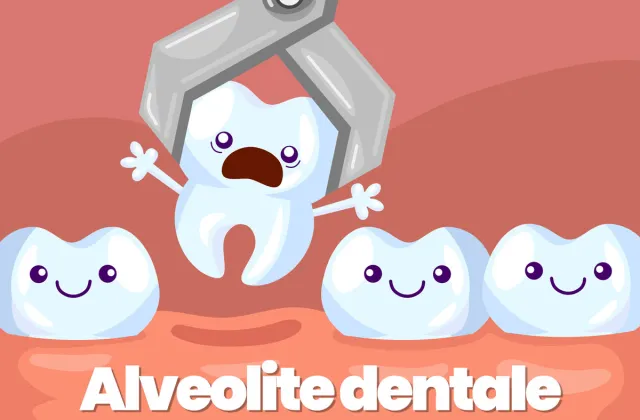 alveolite dentale
