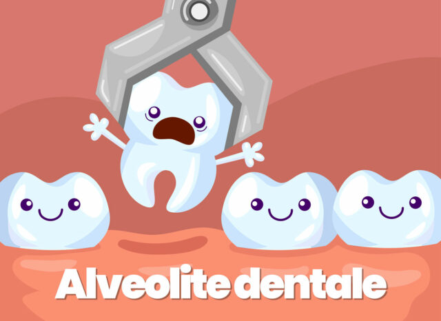 alveolite dentale