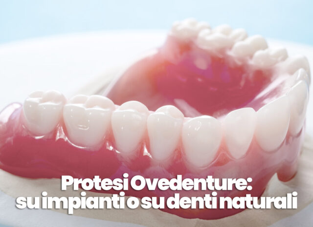 protesi overdenture