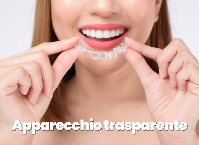 Denti: apparecchio invisibile. Per cosa si usa, benefici e consigli