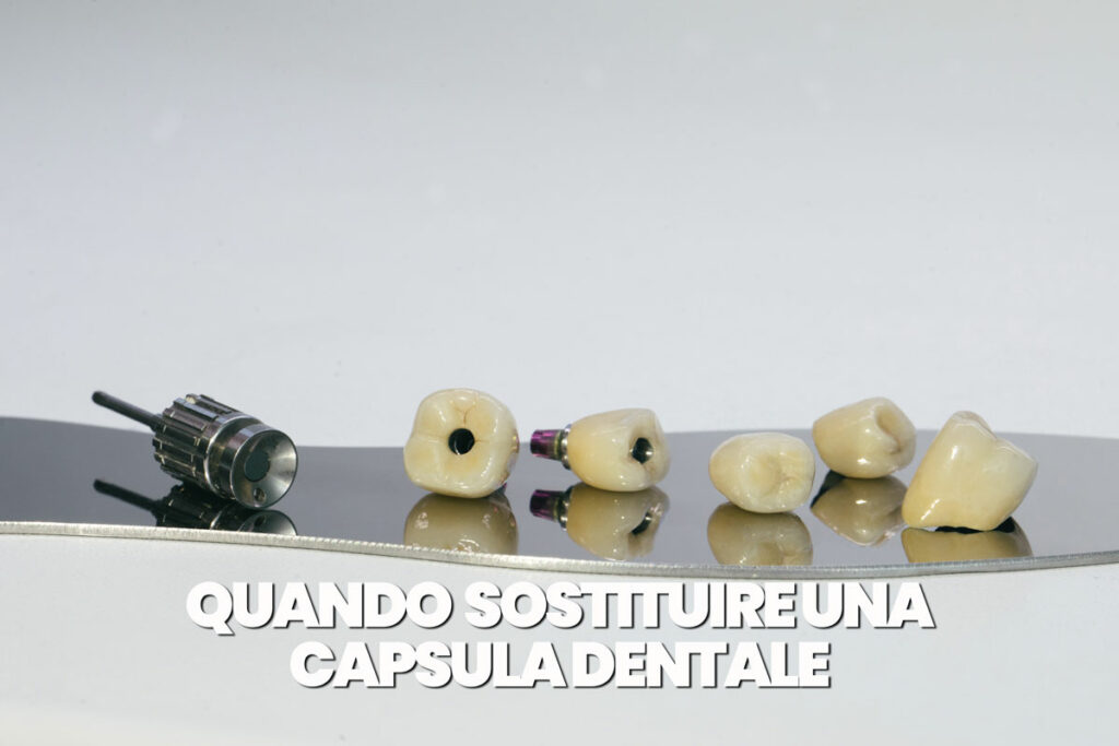 quando sostituire una capsula dentale