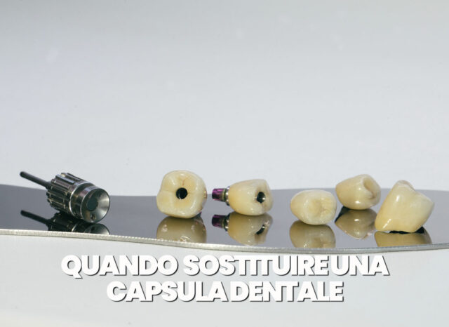 quando sostituire una capsula dentale