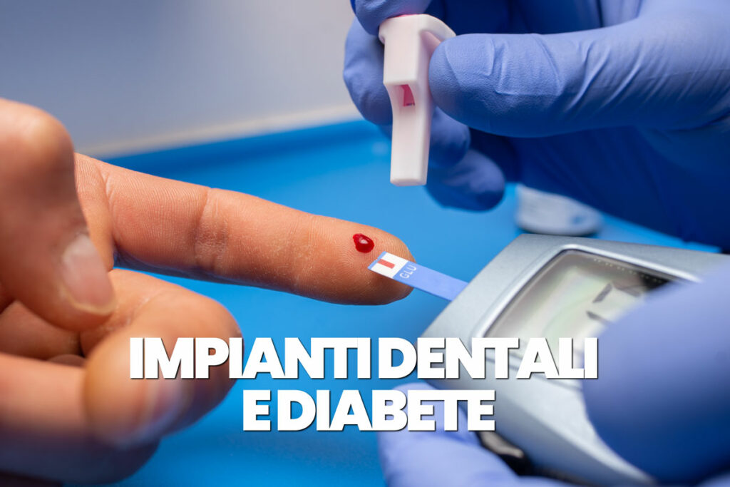 impianti dentali e diabete