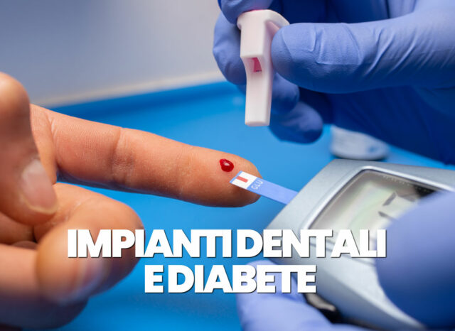 impianti dentali e diabete