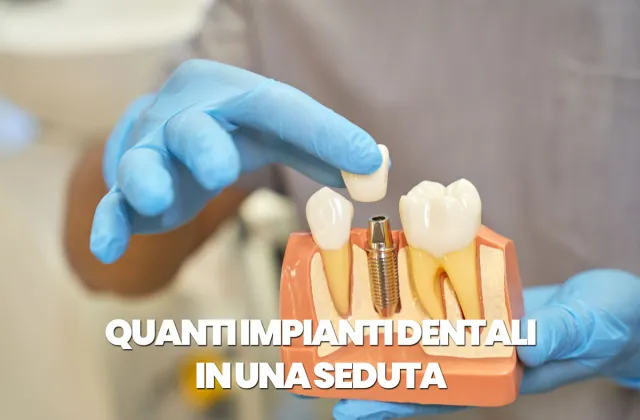 quanti impianti si possono mettere in una seduta